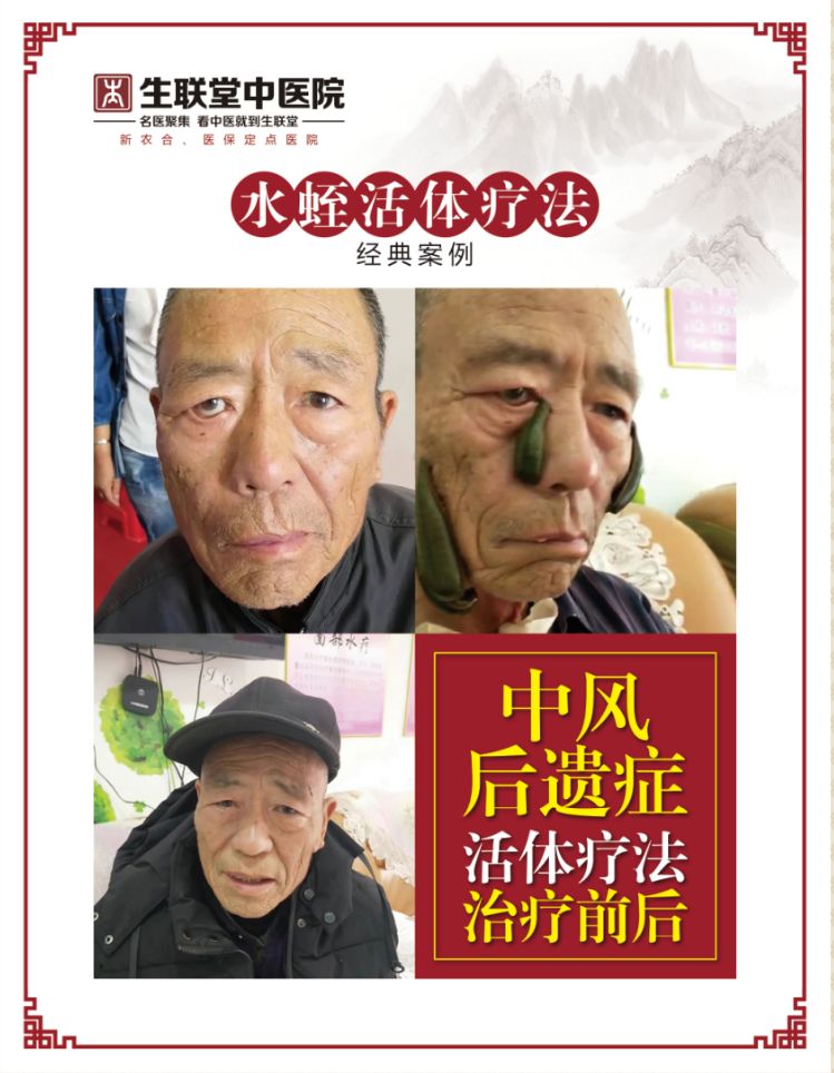 全方位解读FTP服务器的费用构成